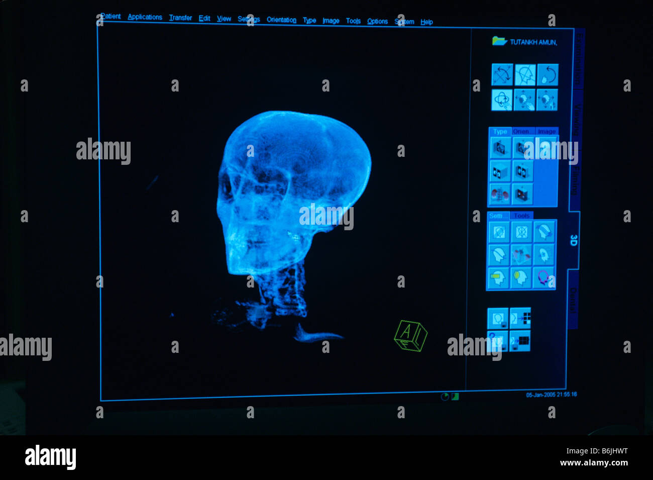 Egypt, CT scan monitor, test performed on mummy of Pharaoh Stock Photo Alamy