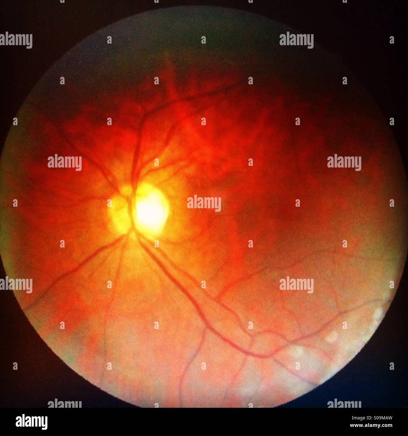 the-inside-of-an-eyeball-stock-photo-alamy